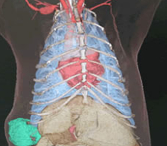 犬の胸のCT画像。緑色の部分は腫瘍の塊