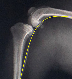 左前十字靭帯断裂・左膝蓋骨内方脱臼